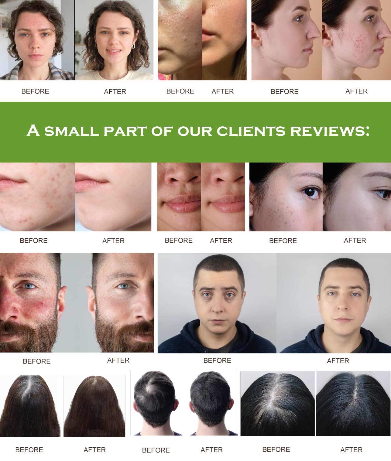 A small part of HEKMA CENTER clients reviews: BEFOR AND AFTER